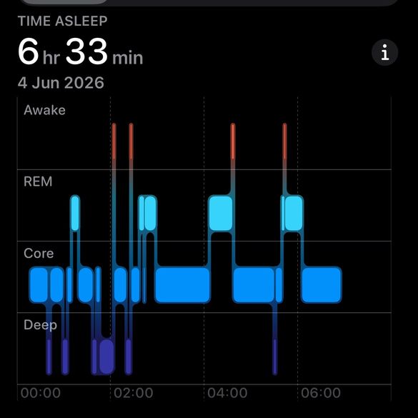 Apple Health and Google Health sleep graphs