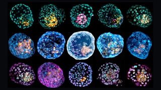 Images shows three rows of stained blastoids, a kind of artificial embryo made from modified skin cells