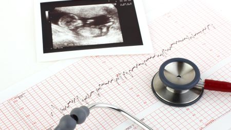 Ultrasound photo and stethoscope.