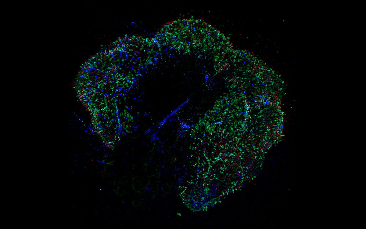 LabGrown 'MiniEyes' Show How Color Vision Develops Live Science