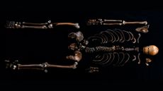 a skeleton laid out against a black background