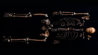 a skeleton laid out against a black background