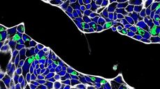 What looks like a black channel is shown running diagonally across the image. On either side of the channel are bunches of blue circles of different shapes and sizes with white edges. In some of the blue circles there are green blobs. 