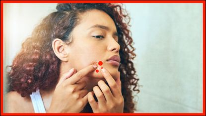 a woman with a pimple overlayed with bubbles representing types of acne