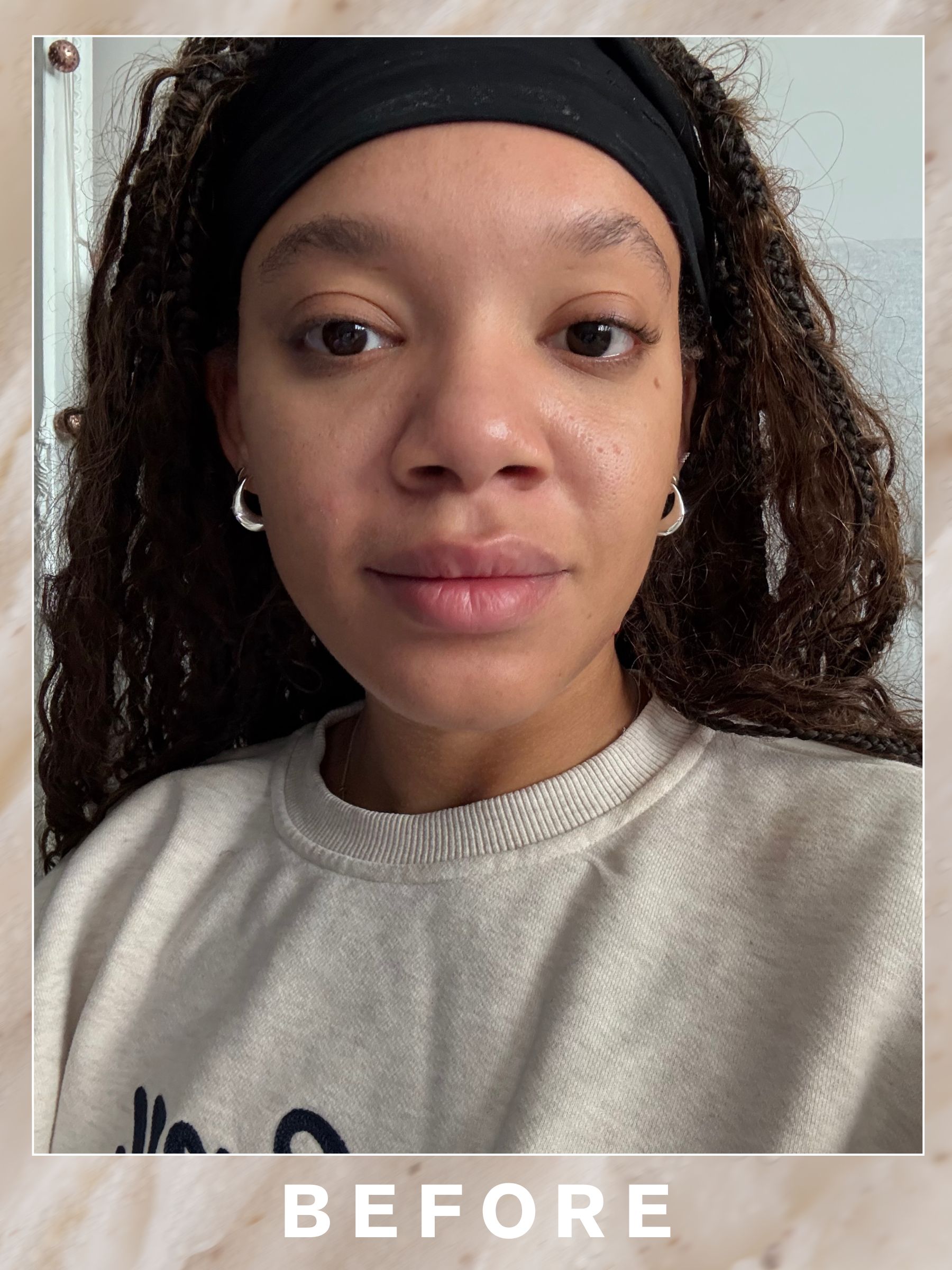 Imani's skin before her Teresa Tarmey facial