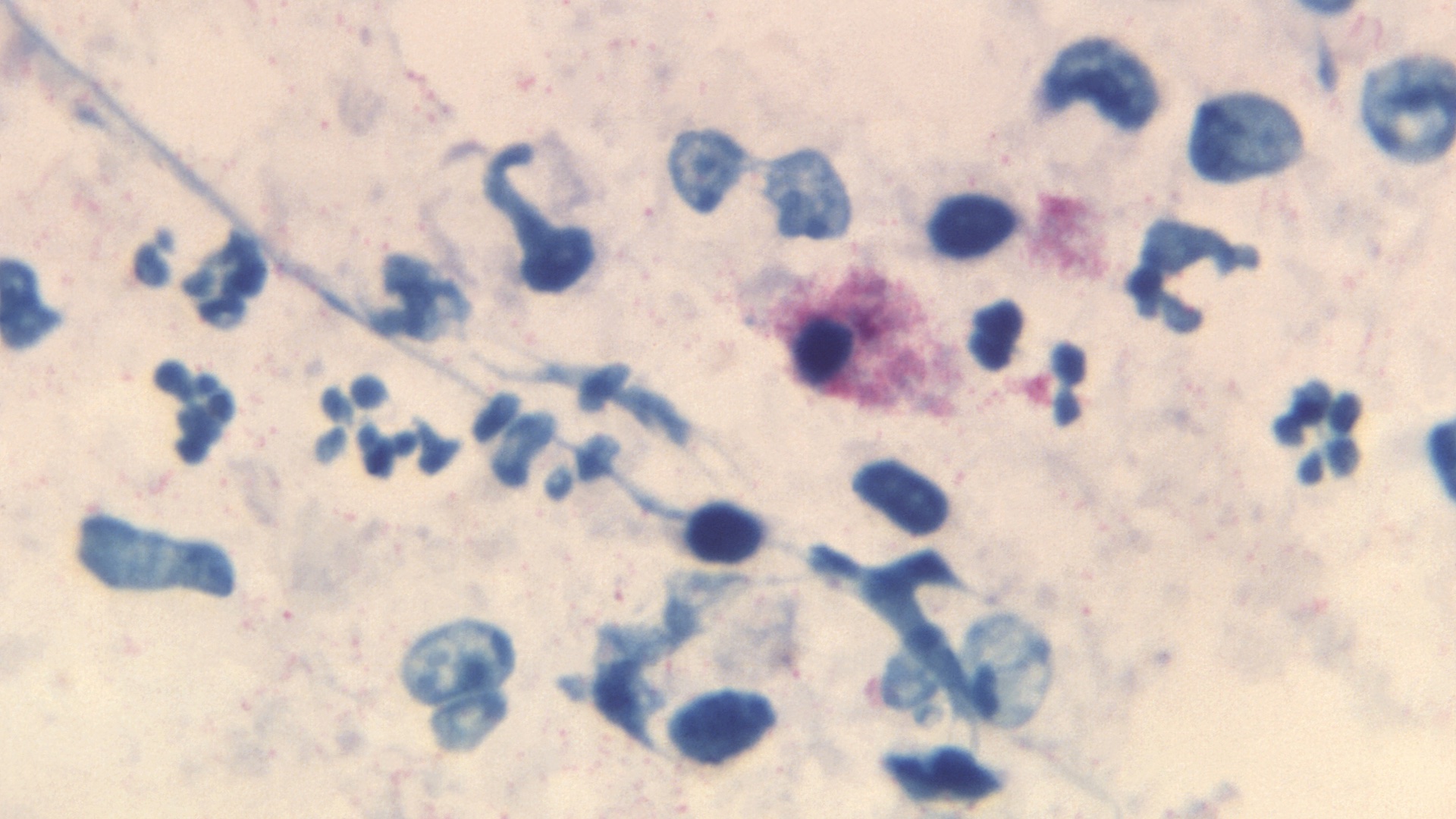 A pictograph of  Chlamydophila psittaci bacterial cells, stained blueittacosis.