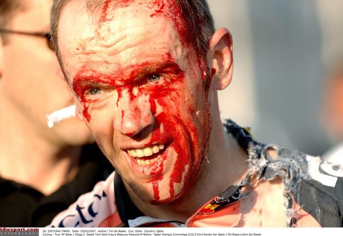 Tom Steels looking ghastly after his crash on stage 2 of the 2007 Tour of Qatar