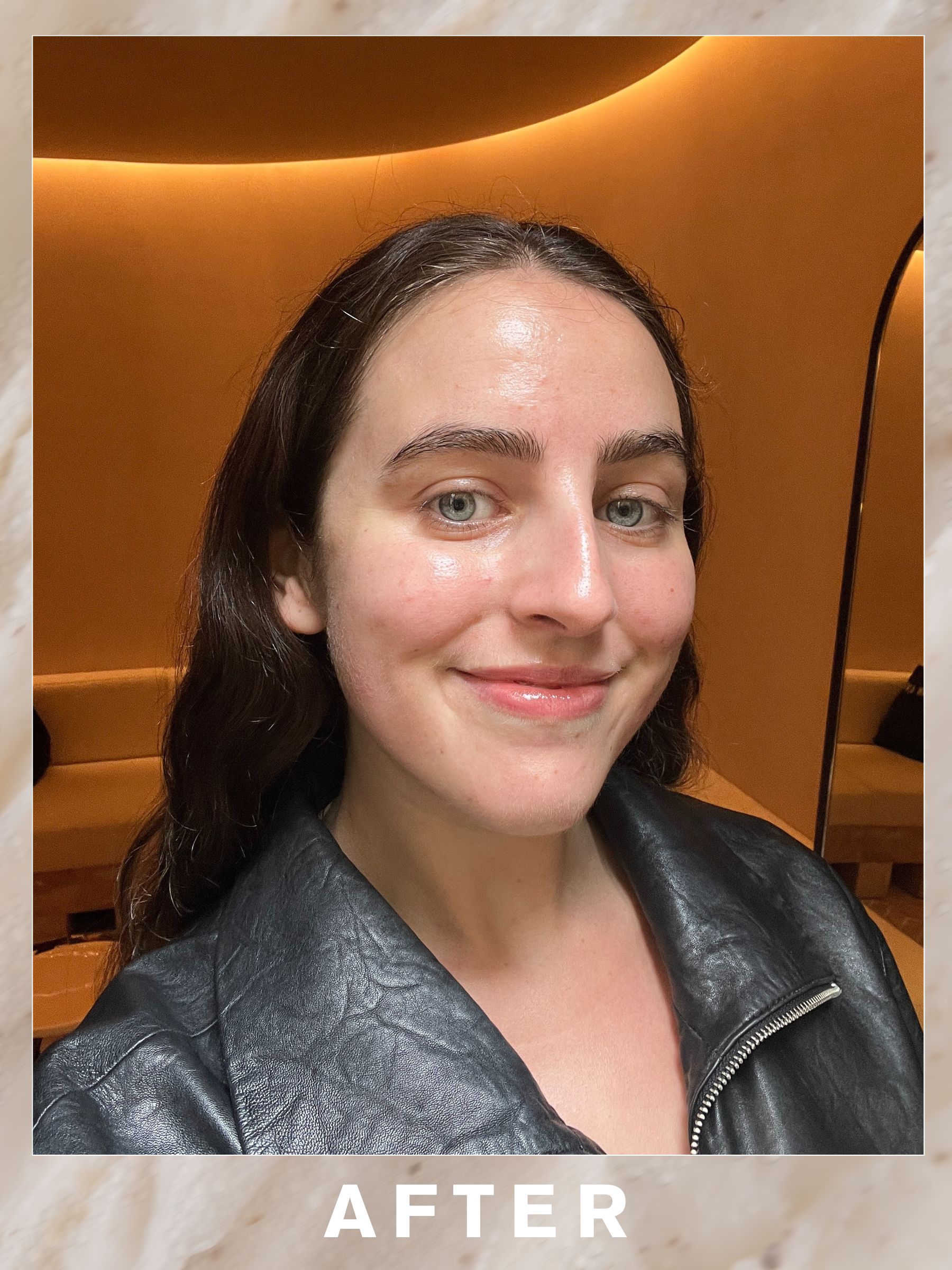 Ava after her Omorovicza Moor Mud Deep Cleansing Facial