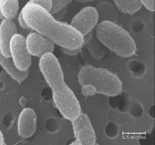 The ultra-small bacteria species, Chryseobacterium greenlandensis, has tiny bud-like structures on its surface, which could play a role in the organism's survival in the Greenland glacier where it was found.
