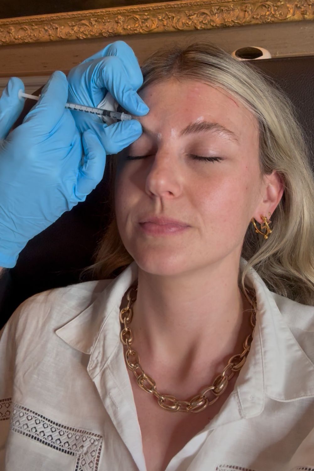 Katie Thomas getting Botox