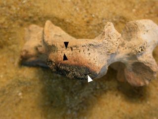 The black arrows here point to three knife marks on the cervical vertebra and the white points to burning.