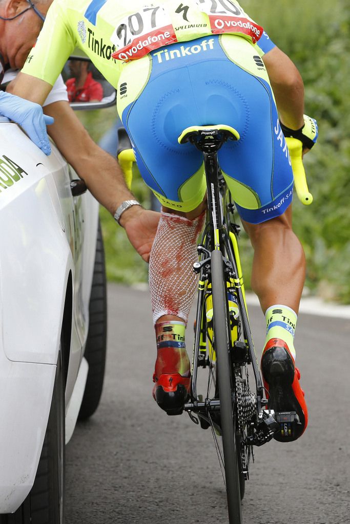 A blood soaked left shoe for Sergio Paulinho