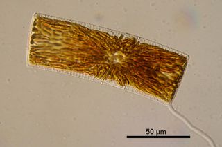 Light micrograph of a live Striatella unipunctata cell. This marine diatom uses a mucilaginous stalk (lower right in image) to anchor to substrates such as rocks, piers or boat hulls.