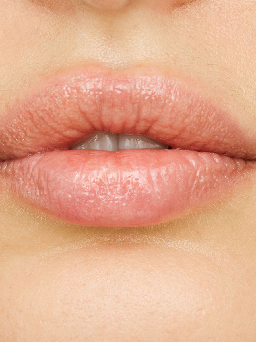 Full, hydrated lips up close