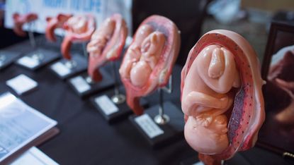 Rubbery fetus dolls in womb