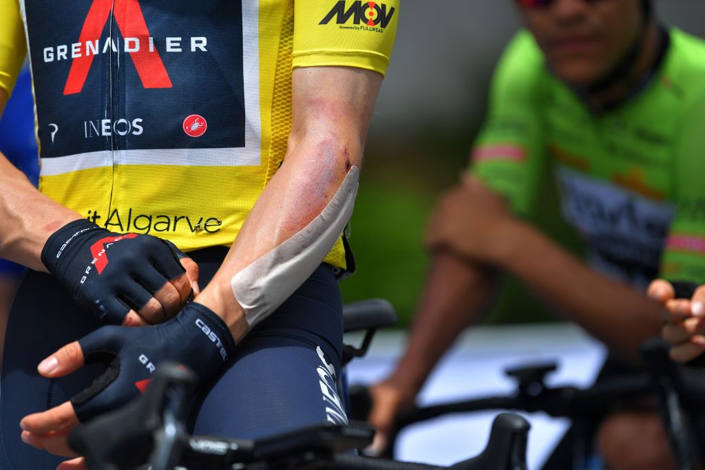 ALTO DO MALHO LOUL PORTUGAL MAY 09 Ethan Hayter of United Kingdom and Team INEOS Grenadiers Yellow Leader Jersey at start Albufeira Village in during the 47th Volta Ao Algarve 2021 Stage 5 a 1701km stage from Albufeira to Alto do Malho 510m Loul Injury Detail view VoltAlgarve VAlgarve2021 on May 09 2021 in Alto do Malho Loul Portugal Photo by Luc ClaessenGetty Images
