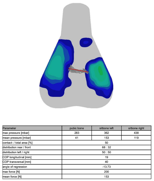 A visual output of saddle pressure mapping