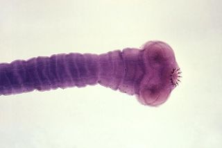 An image of the pork tapeworm <em>Taenia solium</em>.