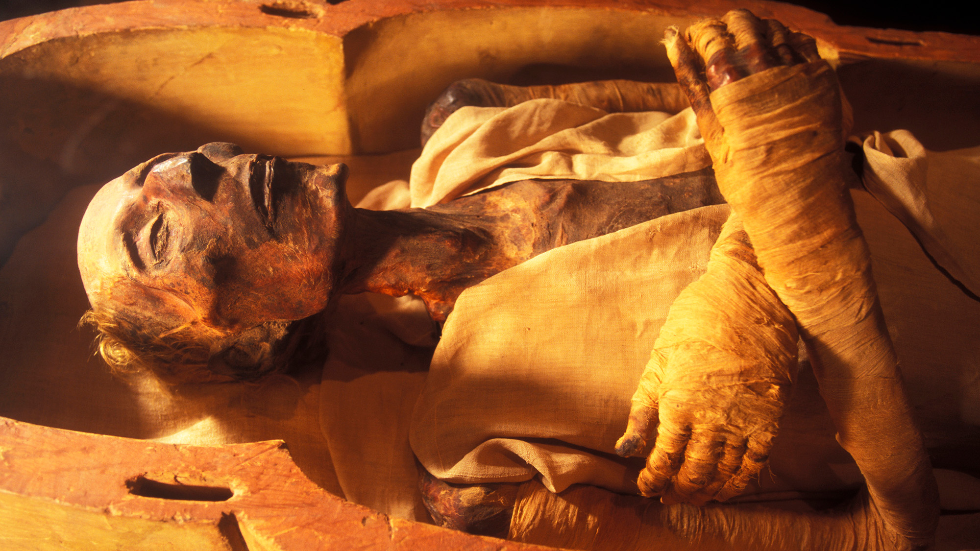 A view of a desiccated mummy inside an open sarcophagus.