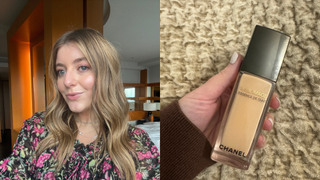 samantha holender wearing foundation for rosacea