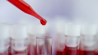 How to prevent blood clots, lab test equipment