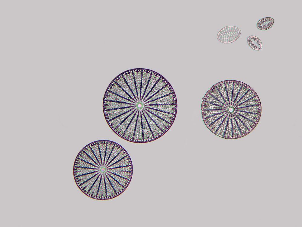 Arachnodiscus, shown at 100x magnification, is a genus of diatom, a type of algae. Some species reach almost 1 millimeter in diameter. The name means &#39;spider disk&#39; because the radiating spokes and ridges on the face evokes a spider&#39;s web.