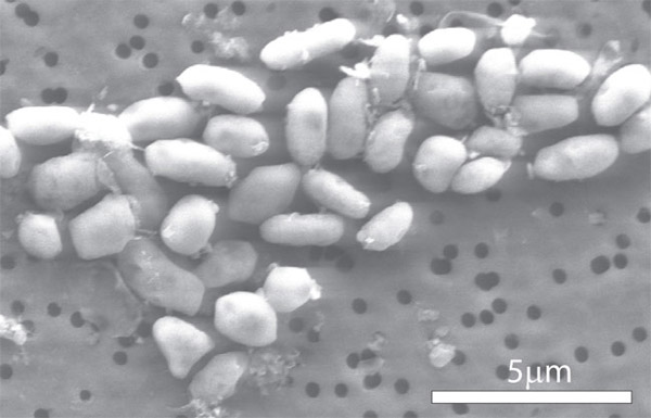 arsenic-eating bacterium called GFAJ-1