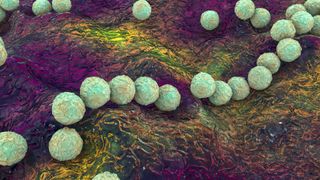 Illustration of the bacteria streptococcus pyogenes. The bacterial cells look like fluorescent light green-ish blue balls that are bunched together in a diagonal line across the image and in a cluster in the top-right-hand corner of the image. The background is undulating and a mixture of dark purple, green and yellow colors.