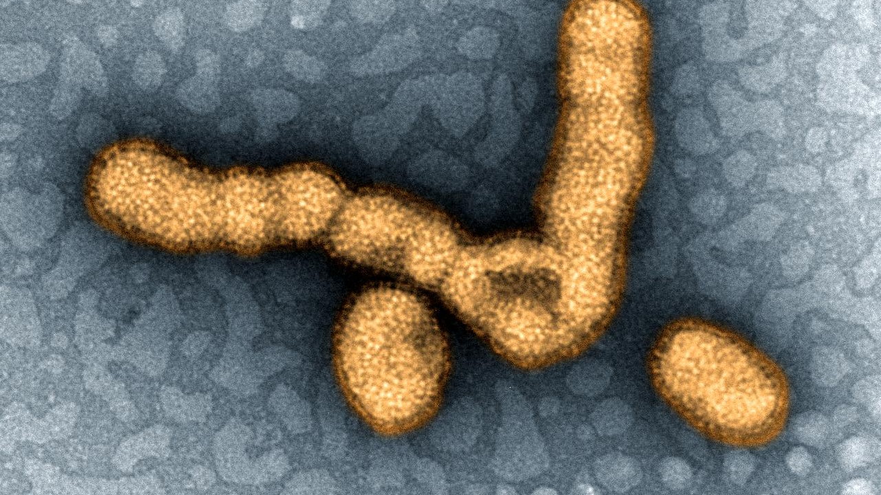 A digitally-colorized image that shows the H1N1 influenza virus under a transmission electron microscope. It looks like an yellow-orange L on it's back with two circles underneath.