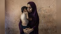 A woman wearing a dark purple hijab gently cradles a severely thin, malnourished child against her chest in front of a cracked, weathered wall.