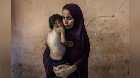 A woman wearing a dark purple hijab gently cradles a severely thin, malnourished child against her chest in front of a cracked, weathered wall.