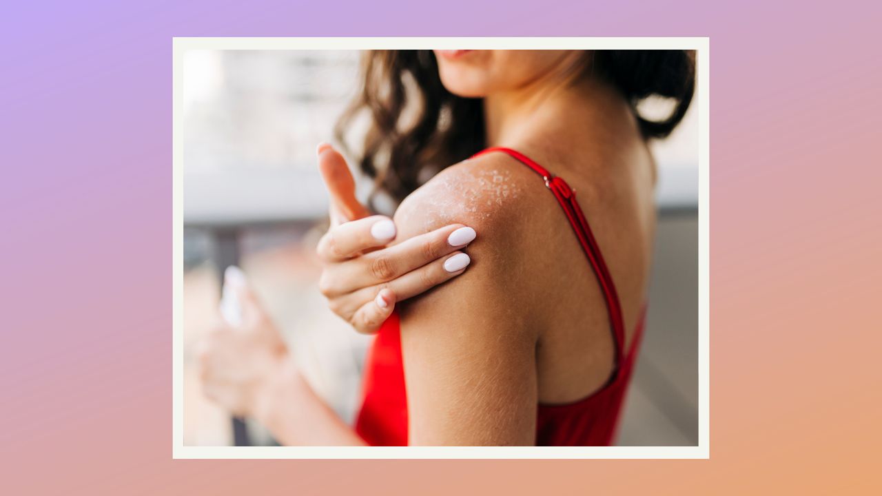 model applying sunscreen to shoulders