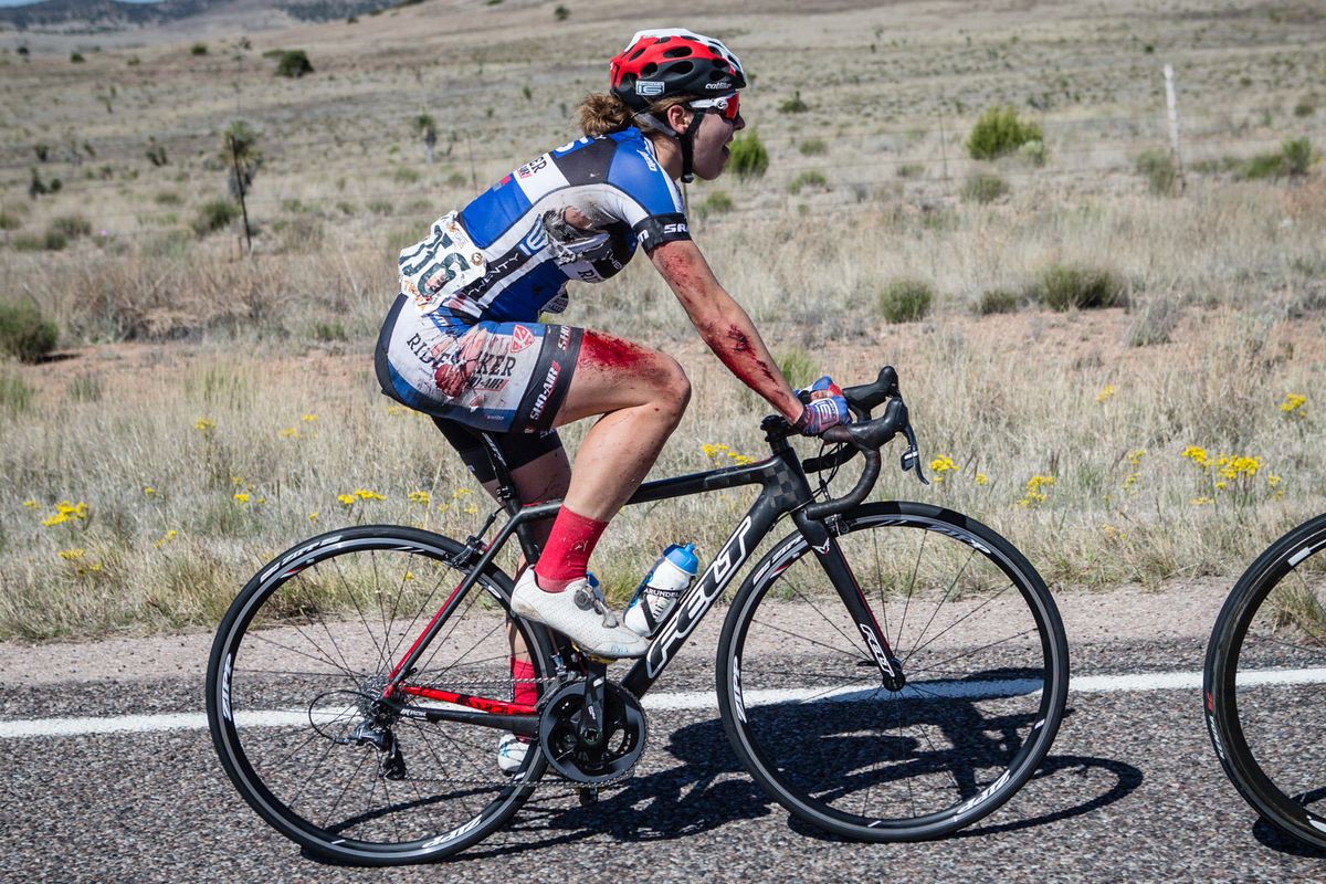 Alison Jackson (Twenty 16) looking scraped up after a crash