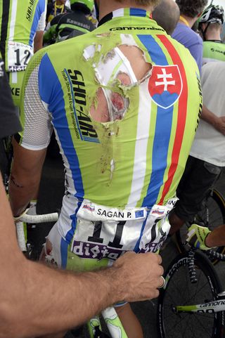 Peter Sagan's injuries after stage one