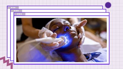 Woman at the spa getting blue LED light therapy treatment on her face set on a purple background template