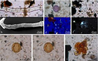 lant remains from the tablets found in the shipwreck: (A) Fiber of flax, (B) Fiber of flax, (C, D, E & F) Starch grain, (G & H) Pollen grain of olive (Olea europaea), (I) Group of pollen grains.