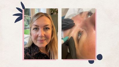 Satah Cooper white pictured before and during microblading