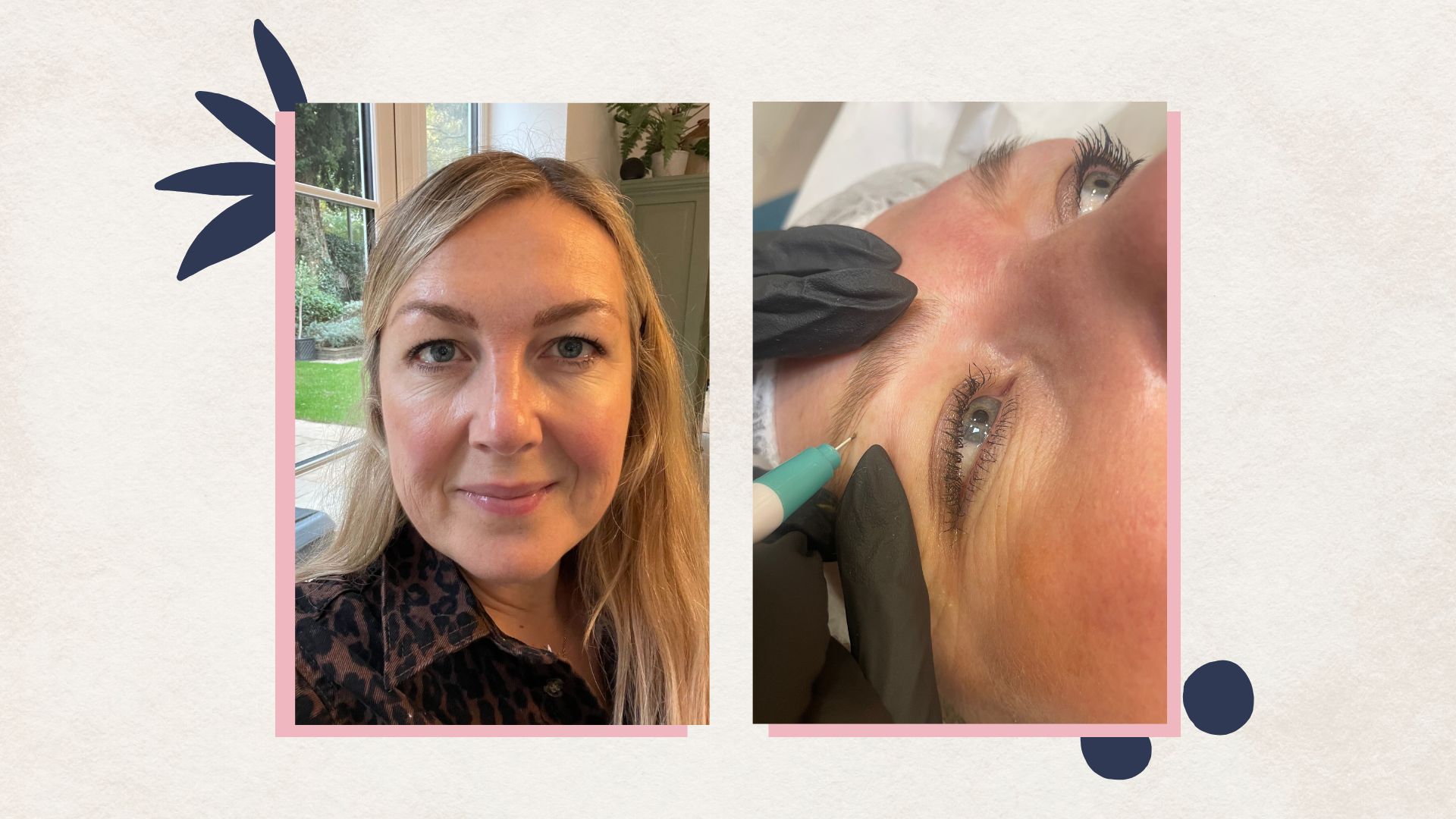 Satah Cooper white pictured before and during microblading