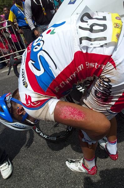 Lee Won Jae (Seoul Cycling) checks on his wounds after crashing in the home straight in Parit Sulong.