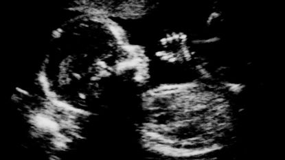 A sonogram image