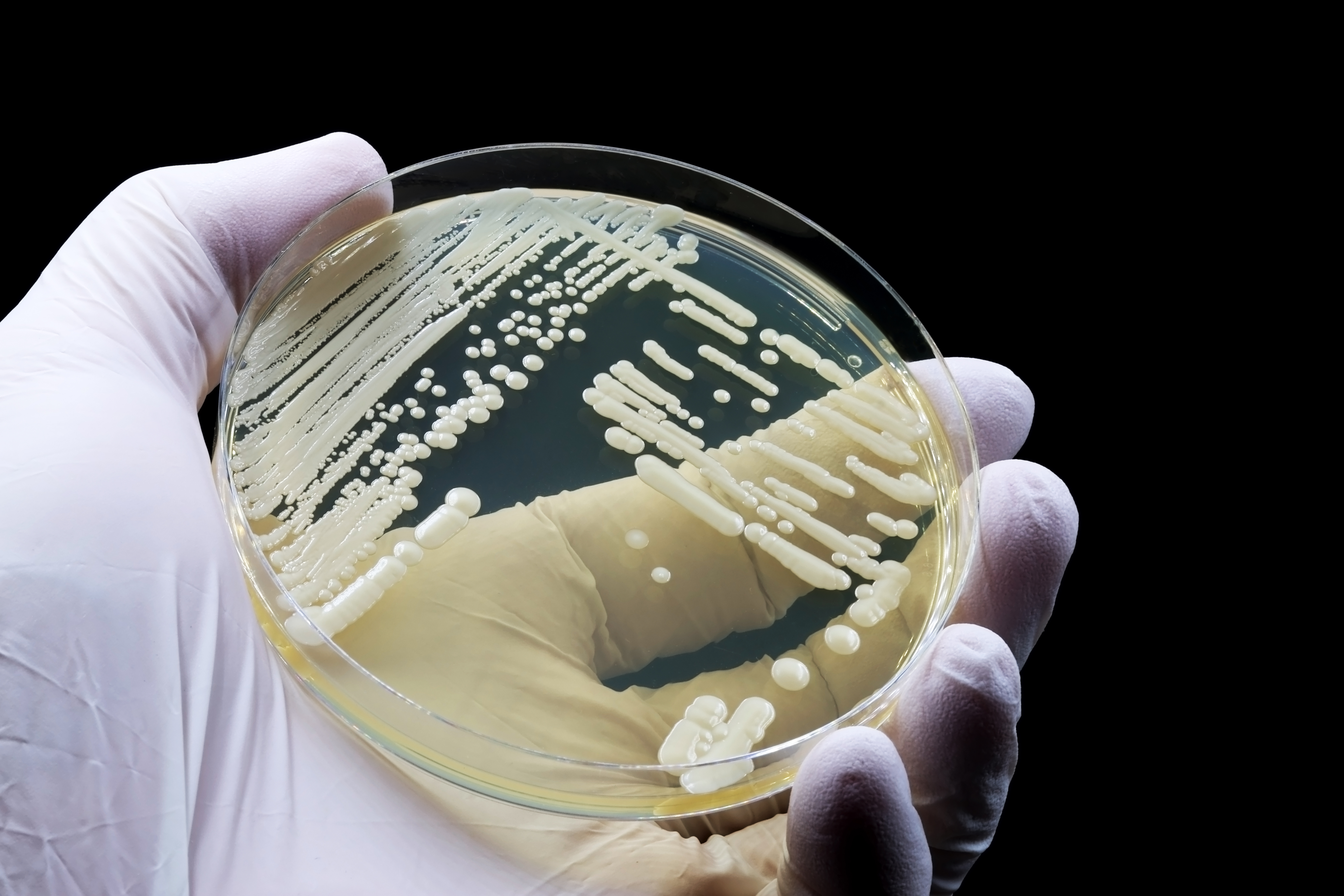 a gloved hand holding a microbiological culture of the yeast Candida auris