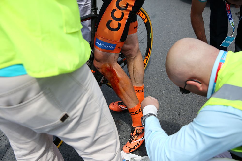 Davide Rebellin's legs after he hit a dog and was forced to abandon the race