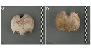 This figure shows traces of red pigment found on the inside and outside of a disarticulated non-adult cranium. This suggests that pigmented hands held the cranium during painting.