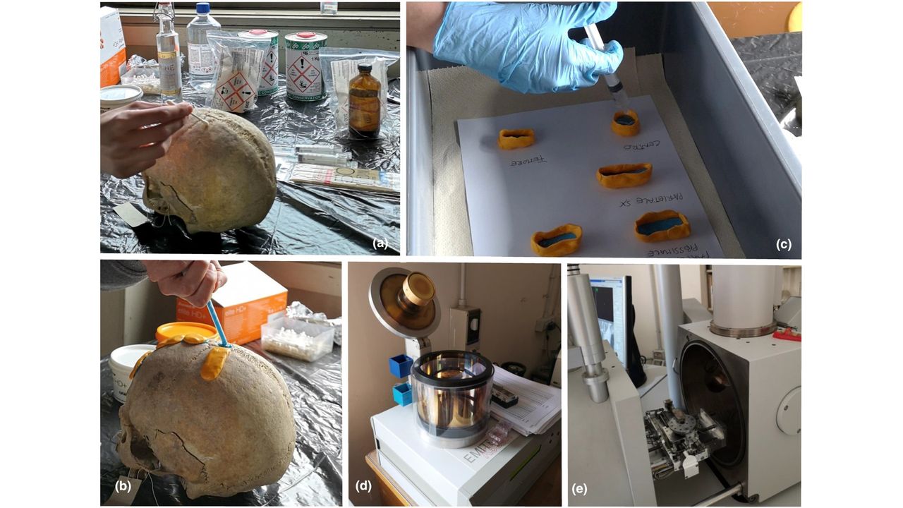 The researchers made silicone molds of the scars on the bones of the skull, and then used the molds to make casts with epoxy resin that they could study.