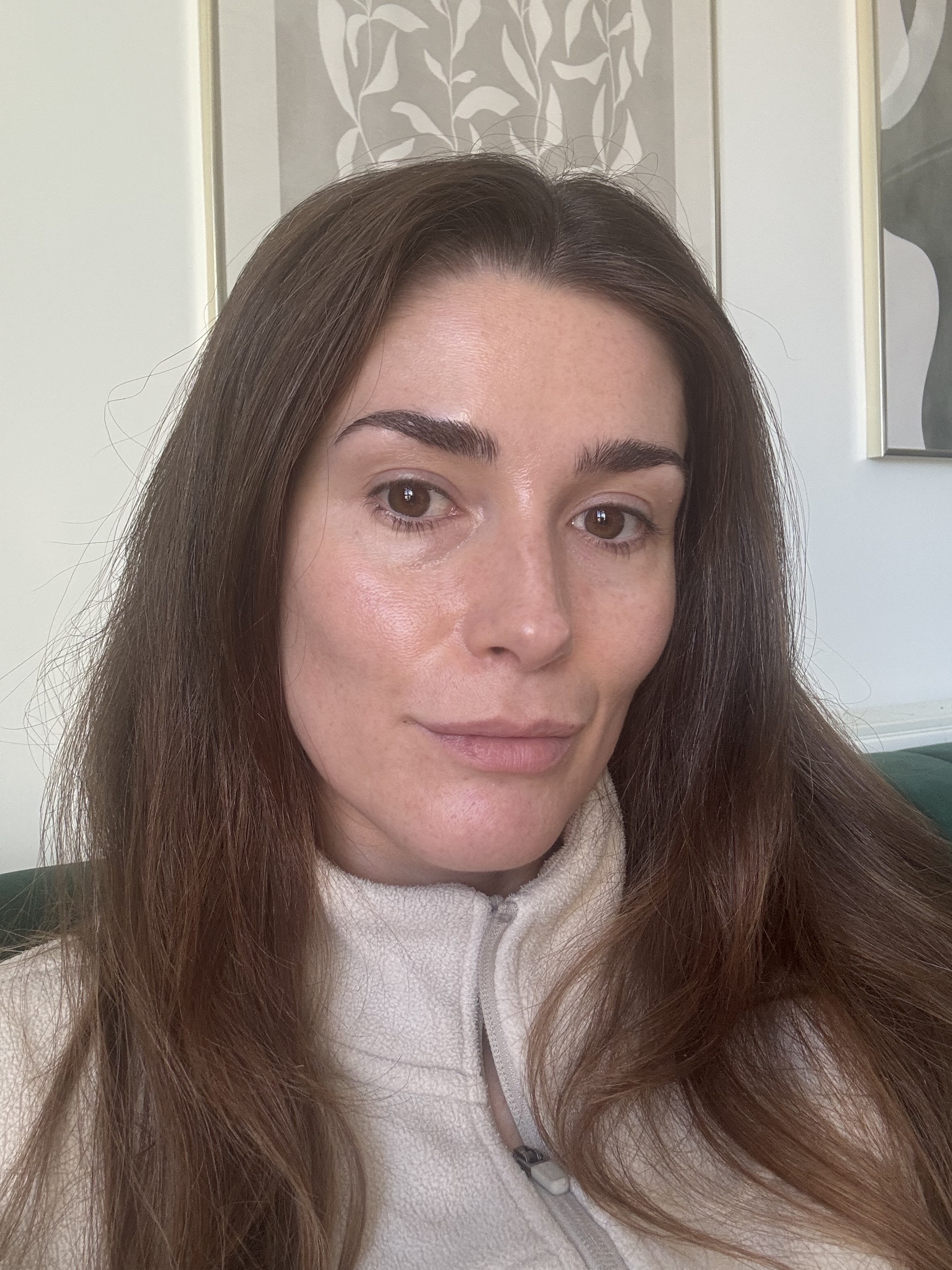 Eleanor's skin one month after using Caudalie vinoperfect serum