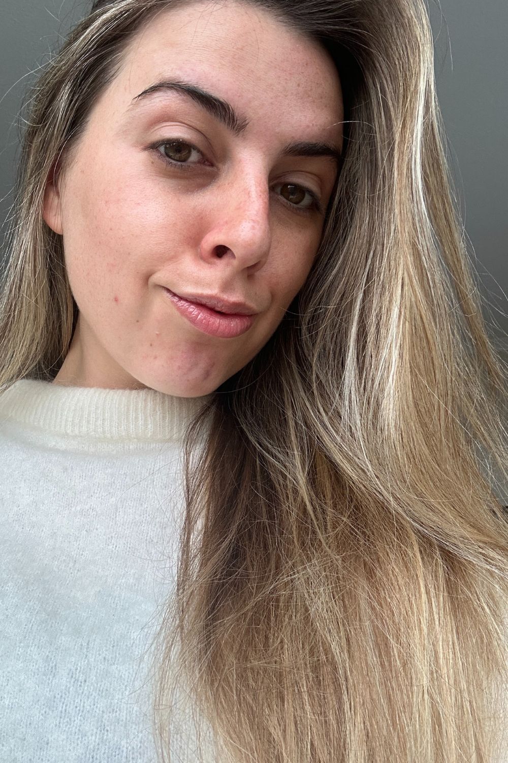 Shannon Laura after using La Roche Posay Mera B3 serum