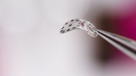 Life-threatening 'leaks' after surgery could be flagged faster with