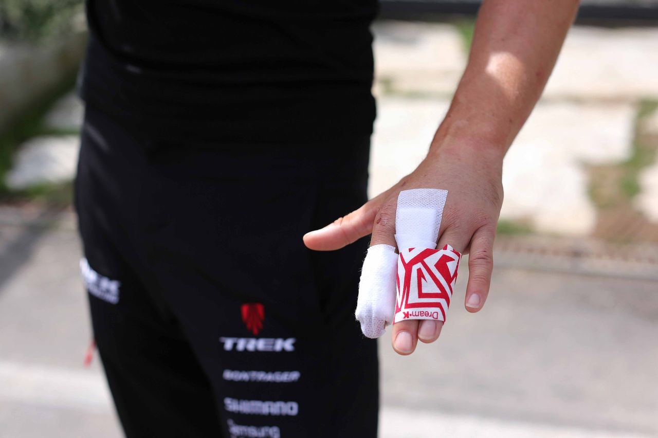 Kristof Vandewalle's left hand all bandaged up for his broken left-finger