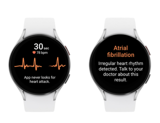 A Samsung Galaxy Watch 5 with the Irregular Heart Rhythm Notification (IHRN) feature