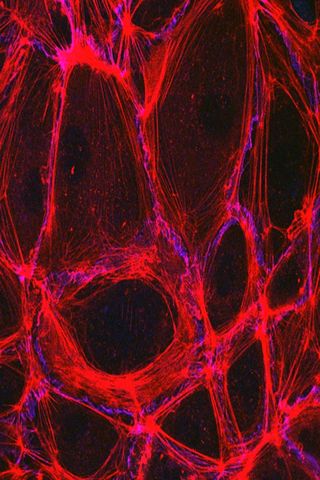 endothelium is the lining of our arteries and veins 